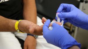 Sanitat notifica les dues primeres morts per hepatitis d’origen desconegut: un nen de 6 anys i un nadó de 15 mesos