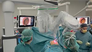 Catalunya estrena el primer robot quirúrgic de la sanitat pública que opera amb una sola incisió o usant orificis naturals del cos
