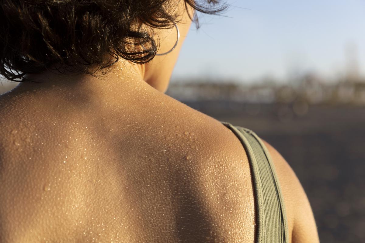 Al·lèrgies al sol: ¿què les provoca i què es pot fer? Al·lèrgies al sol: ¿què les provoca i què es pot fer?