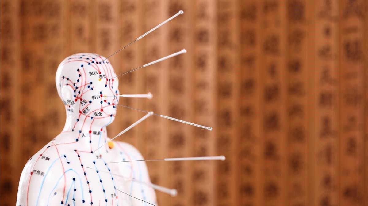 zentauroepp45904957 eastern or asian acupuncture medical treatment shallow dof 190318194210 zentauroepp45904957 eastern or asian acupuncture medical treatment shallow dof 190318194210